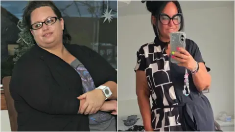 Many Lost Pounds Using Injections – Followed By the Excess Skin